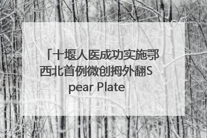 十堰人医成功实施鄂西北首例微创拇外翻Spear Plate髓内板矫形术